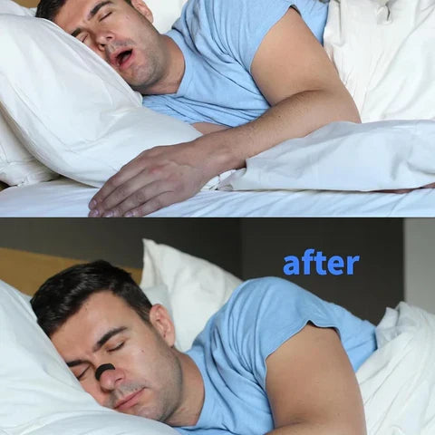 Anti-Snoring Breathing Nasal Strips